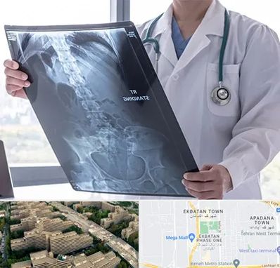 رادیولوژی شبانه روزی در اکباتان 