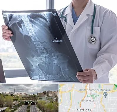 رادیولوژی شبانه روزی در یوسف آباد 