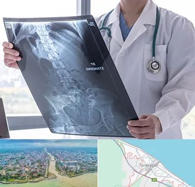 رادیولوژی شبانه روزی در تنکابن