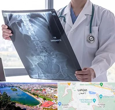 رادیولوژی شبانه روزی در لاهیجان