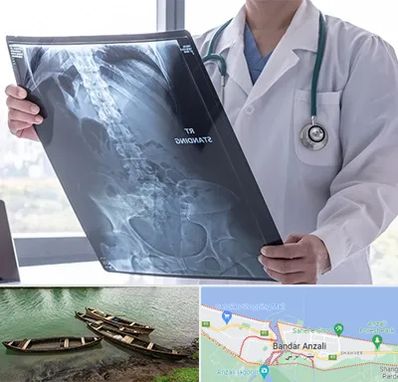 رادیولوژی شبانه روزی در بندر انزلی