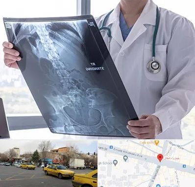 رادیولوژی شبانه روزی در شهناز تبریز