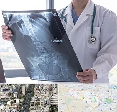 رادیولوژی شبانه روزی در منطقه 18 تهران 