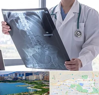 رادیولوژی شبانه روزی در منطقه 22 تهران 