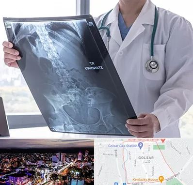 رادیولوژی شبانه روزی در گلسار رشت 