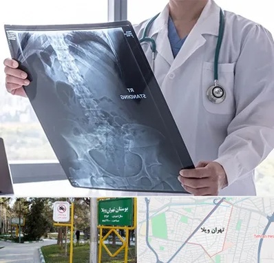 رادیولوژی شبانه روزی در تهران ویلا