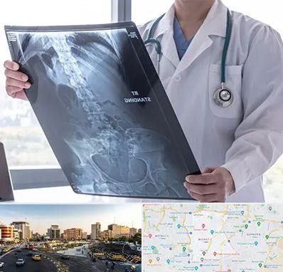 رادیولوژی شبانه روزی در منطقه 7 تهران 