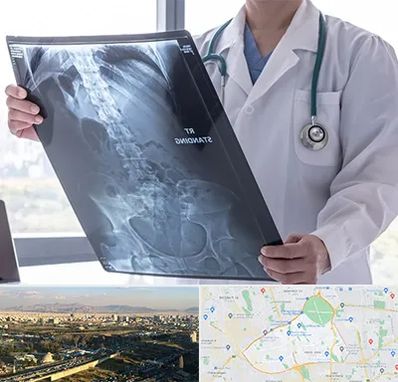 رادیولوژی شبانه روزی در منطقه 19 تهران 