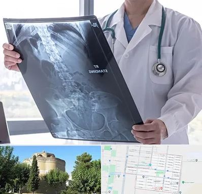 رادیولوژی شبانه روزی در مرداویج اصفهان