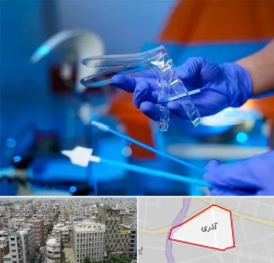 تست پاپ اسمیر در آذری