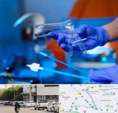 تست پاپ اسمیر در قدوسی شرقی شیراز