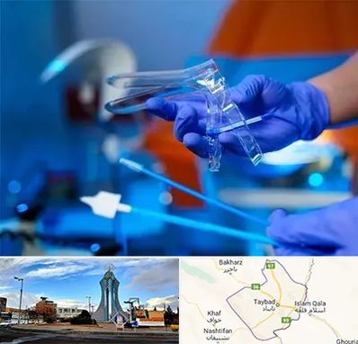 تست پاپ اسمیر در تایباد