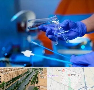 تست پاپ اسمیر در فاز سه اندیشه