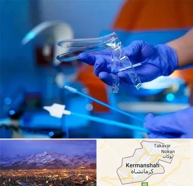 تست پاپ اسمیر در کرمانشاه