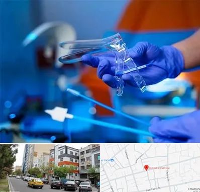 تست پاپ اسمیر در هفده شهریور تبریز