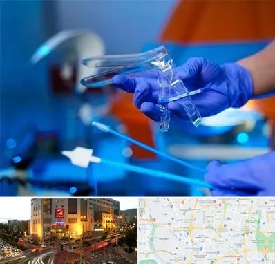 تست پاپ اسمیر در جنت آباد تهران 