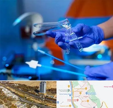 تست پاپ اسمیر در خیابان نیایش شیراز