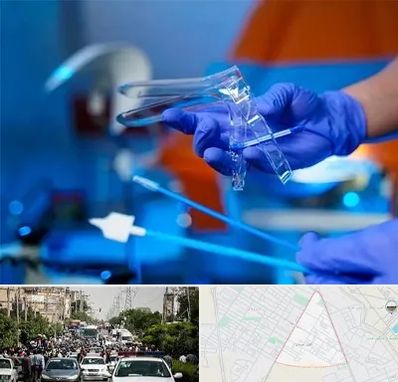 تست پاپ اسمیر در سیدی مشهد