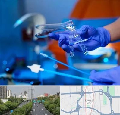 تست پاپ اسمیر در توانیر