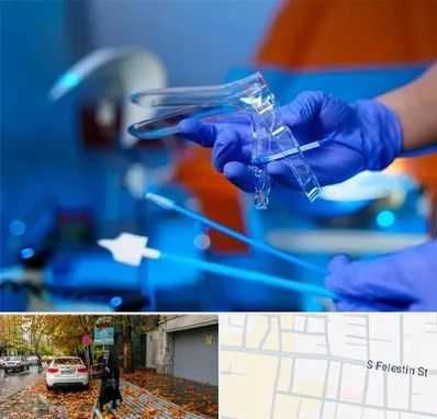 تست پاپ اسمیر در خیابان فلسطین