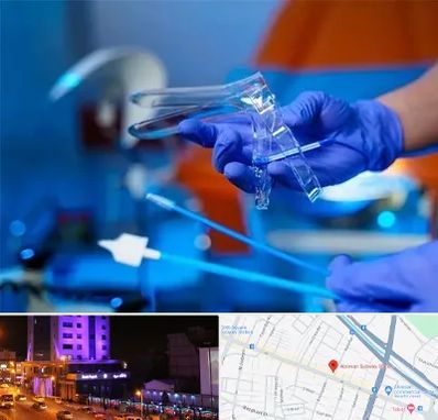 تست پاپ اسمیر در آبرسان تبریز