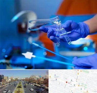 تست پاپ اسمیر در بلوار معلم مشهد 