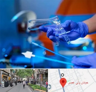 تست پاپ اسمیر در ولیعصر شهریار