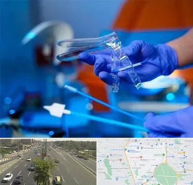 تست پاپ اسمیر در منطقه 17 تهران 