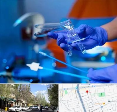 تست پاپ اسمیر در کوی فیروز تبریز