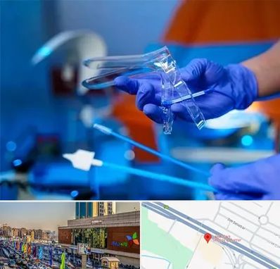 تست پاپ اسمیر در لاله پارک تبریز