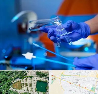 تست پاپ اسمیر در وکیل آباد مشهد 