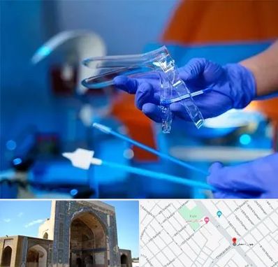 تست پاپ اسمیر در مصلی مشهد