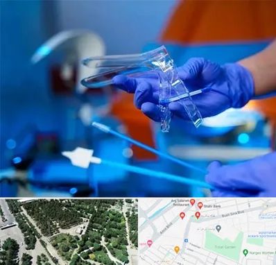 تست پاپ اسمیر در سالاریه قم