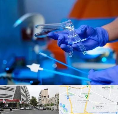 تست پاپ اسمیر در بلوار فردوس 