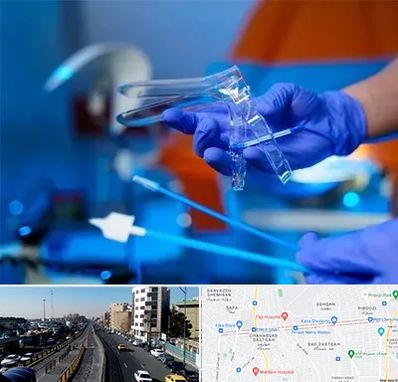 تست پاپ اسمیر در پیروزی 