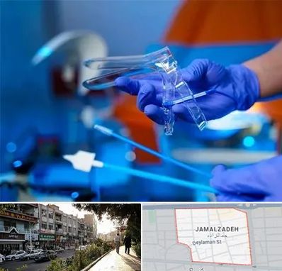 تست پاپ اسمیر در خیابان جمالزاده