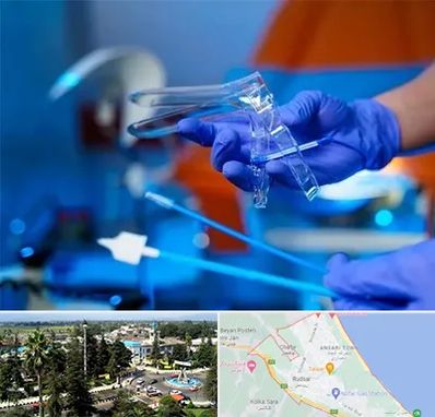 تست پاپ اسمیر در رودسر