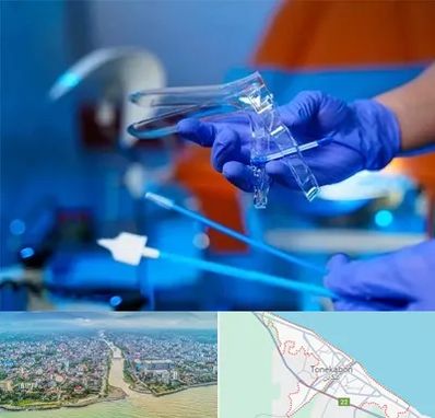 تست پاپ اسمیر در تنکابن