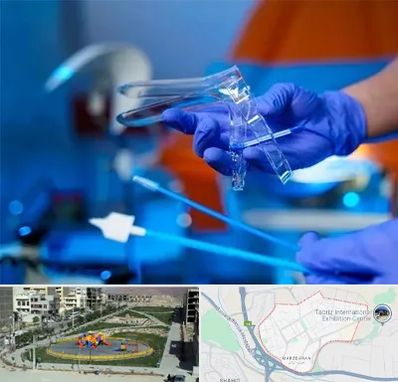 تست پاپ اسمیر در مرزداران تبریز