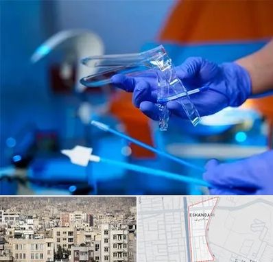 تست پاپ اسمیر در اسکندری