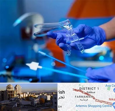 تست پاپ اسمیر در فرمانیه 