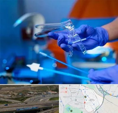 تست پاپ اسمیر در یاغچیان تبریز