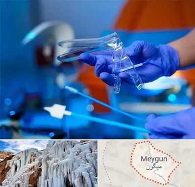 تست پاپ اسمیر در میگون