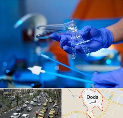 تست پاپ اسمیر در شهر قدس