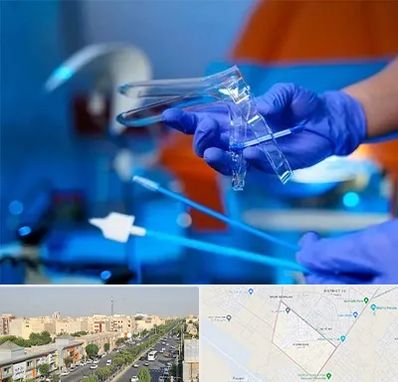 تست پاپ اسمیر در کیانمهر کرج