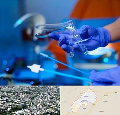 تست پاپ اسمیر در شاهرود