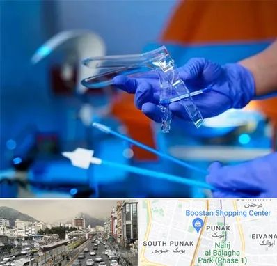 تست پاپ اسمیر در پونک 