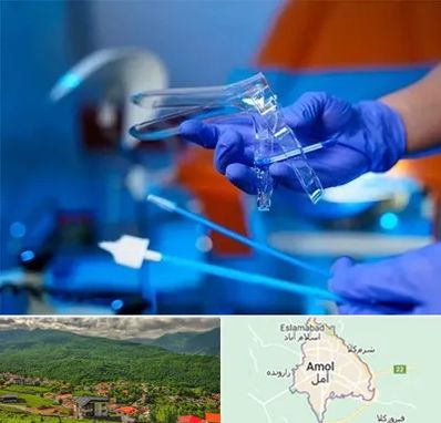 تست پاپ اسمیر در آمل