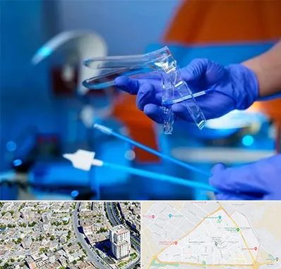 تست پاپ اسمیر در قاسم آباد مشهد 