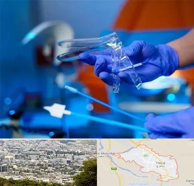 تست پاپ اسمیر در یاسوج